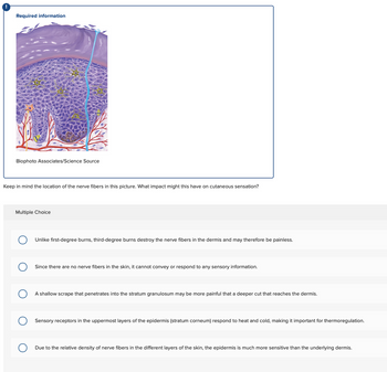 Required information
Biophoto Associates/Science Source
Keep in mind the location of the nerve fibers in this picture. What impact might this have on cutaneous sensation?
Multiple Choice
Unlike first-degree burns, third-degree burns destroy the nerve fibers in the dermis and may therefore be painless.
Since there are no nerve fibers in the skin, it cannot convey or respond to any sensory information.
A shallow scrape that penetrates into the stratum granulosum may be more painful that a deeper cut that reaches the dermis.
Sensory receptors in the uppermost layers of the epidermis (stratum corneum) respond to heat and cold, making it important for thermoregulation.
Due to the relative density of nerve fibers in the different layers of the skin, the epidermis is much more sensitive than the underlying dermis.