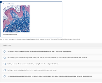 !
Required information
Dennis Strete/McGraw Hill
Use this picture to compare the tissue structure in the papillary and reticular layers of the dermis. Which of the following best describes your observations?
Multiple Choice
The papillary layer is a thick layer of tightly packed dead skin cells, while the reticular layer is much thinner and more fragile.
The papillary layer is dominated by large, empty-looking cells, while the reticular layer is made of a loose network of fibers infiltrated with white blood cells.
Both layers consist of a loose arrangement of thin, branching fibers in abundant ground substance.
Both layers contain packed, parallel fibers, but the papillary dermis is thicker and much denser.
The reticular layer is thicker and more fibrous. The papillary layer is a thinner zone of more loosely organized tissue containing many "wandering" white blood cells.