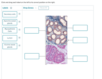 Click and drag each label on the left to its correct position on the right.
Labels
Drop Zones ←
Reset All
Secretory cells
Apocrine sweat
glands
Myoepithelial
Cells
Lumen
Eccrine sweat
glands
☐☐ ☐