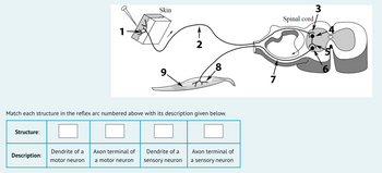 Structure:
Match each structure in the reflex arc numbered above with its description given below.
Description:
Dendrite of a
motor neuron
Skin
Axon terminal of
a motor neuron
2
Dendrite of a
sensory neuron
Axon terminal of
a sensory neuron
7
Spinal cord
3