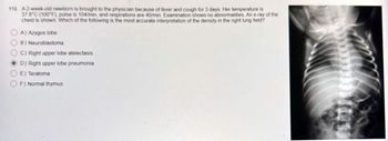 119 A2-week-old newborn is brought to the physician because of fever and cough for 3 days. Her temperature is
37.8°C (100°F), pulse is 104/min, and respirations are 40/min. Examination shows no abnormalities. An x-ray of the
chest is shown. Which of the following is the most accurate interpretation of the density in the right lung field?
A) Azygos lobe
B) Neuroblastoma
C) Right upper lobe atelectasis
OD) Right upper lobe pneumonia
E) Teratoma
OF) Normal thymus