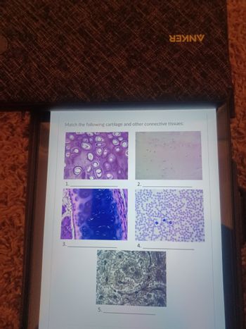 Match the following cartilage and other connective tissues:
3.
5.
2.
SEXINV
4.