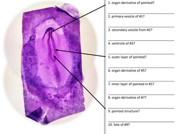 1. organ derivative of pointed?
2. primary vesicle of #1?
3. secondary vesicle from #2?
4. ventricle of #3?
5. outer layer of pointed?
6. organ derivative of #5?
7. inner layer of pointed in #5?
8. organ derivative of #7?
9. pointed structure?
10. fate of #9?