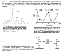 (a) To illustrate how the ADP phosphorylative capacity was measured, the diagram below on
the left shows a ³1P NMR spectrum of the arm of a control female subject at rest, and the diagram on
the right the changes measured in the creatine and phosphocreatine levels of the arm at rest and
exercise.
PCr
10 Exer
-cise
Exer
→→→Rest◄cise Rest
PCr/Pi 9
PCr
15
20
10
Time(min)
Isokinetic ergometer exercise of the control female
subject showing intervals of rest and exercise. To
obtain this graph, a ³1P NMR spectrum was col-
lected every 2 min to show the changes in the PCr
and Pi content of the arm skeletal muscle tissue.
NH₂
during
activity
+
ATP +
C=NH2
during
recovery
YATP
Pi
GATP
BATP
SP
15
0
10
15
20
25
5
ppm
31P NMR spectrum of the arm of a control sub-
ject at rest showing characteristic resonance
features for the phosphate residues of ATP,
phosphocreatine (PCr), and Pi. At rest the
PCr/Pi ratio is ordinarily ~ 8-9.
The synthesis of phosphocreatine is unfavorable. If dur-
ing extended periods of rest, e.g., sleeping at night,
what must be the ADP/ATP ratio if the resting level of
PCr/Cr is 30/1?
0™
-0-P=0
N-H
+
C=NH₂2+ ADP
CH3-N
CH₂
COO™
Phosphocreatine
CH3-N
CH ₂
COO™
Creatine