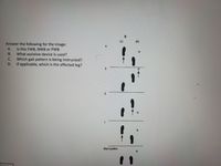 (L)
(R)
Answer the following for the image:
Is this FWB, NWB or PWB
What assistive device is used?
А.
B.
Which gait pattern is being instructed?
If applicable, which is the affected leg?
C.
D.
3.
Start position
