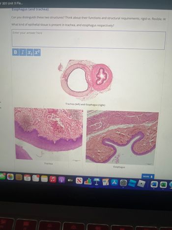 Y 301 Unit 3 Fla...
Esophagus (and trachea):
Can you distinguish these two structures? Think about their functions and structural requirements, rigid vs. flexible. W
What kind of epithelial tissue is present in trachea, and esophagus respectively?
20
Enter your answer here
BIX₂x²
Trachea
A
Trachea (left) and Esophagus (right)
tv
Esophagus
MORE
W