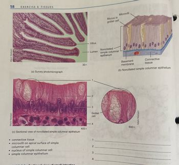 Answered: breden falt COTERAP (c) Sectional view… | bartleby