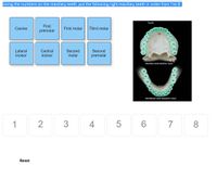 Using the numbers on the maxillary teeth, put the following right maxillary teeth in order from 1 to 8.
Тeeth
First
Canine
First molar
Third molar
premolar
14
15
Second
molar
Lateral
Central
Second
incisor
incisor
premolar
Maxillary teeth (Inferior view)
17
18
31
19
30
20
Mandibular teeth (Superior view)
1
3
4
6.
7
8
Reset
LO
2.
