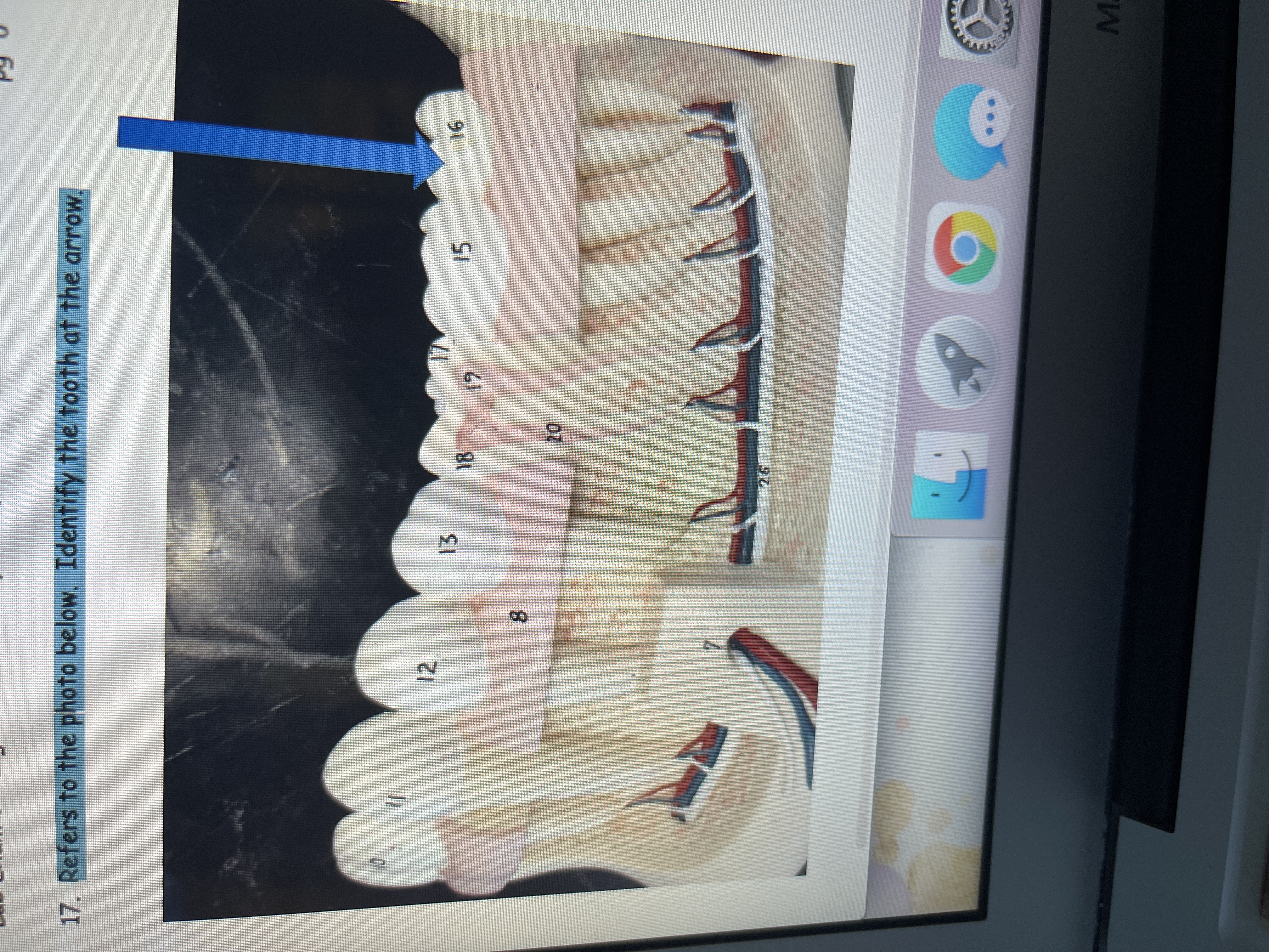 **Dental Anatomy Model Explanation**

In this detailed dental model, a segment of human teeth is labeled with numbers for educational purposes. The model displays both the external and internal structures.

- Teeth are numbered from 10 to 16, representing different types typically found in one section of the mouth.
- Tooth number 16 is highlighted by a blue arrow, indicating it should be identified.
- The numbers also show gum, bone, and root structures, labeled as 7, 8, and 26 respectively.
- Arteries and nerves are depicted, showing how they integrate with each tooth.

This model is used to understand dental anatomy, including identifying specific teeth and their associated structures.