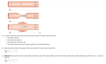 (ii)
V (iii)
0
1
V
2
(ii)
V (iii)
(2 0.30 cm
2
1.70 cm
1.00 cm
(a) In which of the three blood vessels would the blood be flowing at a higher speed at point 2?
the healthy vessel (i)
the constricted vessel (ii)
the vessel with an aneurysm (iii)
The blood is flowing at the same speed at point 2 in all three blood vessels.
1.00 cm
(b) What would be the ratio of the speeds of the blood at point 2 in blood vessels (ii) and (iii)?
V
1.00 cm
(c) What If? What would be the ratio of the speeds of the blood at point 2 in blood vessels (ii) and (iii) if the blood vessels were oriented vertically and point 2 were 11.4 cm above
point 1?