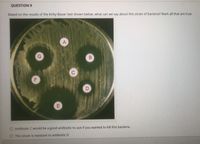 QUESTION 9
Based on the results of the Kirby-Bauer test shown below, what can we say about this strain of bacteria? Mark all that are true.
G.
O Antibiotic C would be a good anitbiotic to use if you wanted to kill this bacteria.
O This strain is resistant to antibiotic D
B.
D.
E.
F.
