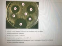 B
D.
O Antibiotic C would be a good anitbiotic to use if you wanted to kill this bacteria.
O This strain is resistant to antibiotic D
This strain is susceptible to antibiotic G
O This strain is more susceptible to antibiotic B than F
O Antibiotic F would (probably) be the best antibiotic to use if someone were infected with this bacteria
OThis strain is resistant to antibiotic A
E.
F.
