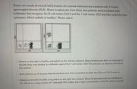 Shown are results of clinical FACS analysis of a normal individual and a patient with X-linked
agammaglobulinemia (XLA). Blood lymphocytes from these two patients were incubated with
antibodies that recognize the B-cell marker CD19 and the T-cell marker CD3 and then sorted by flow
cytometry. Which patient is healthy? Please select.
CD3
CD3
O Patient on the right is healthy and patient on the left has a disease. Blood lymphocytes from an individual on
the left show only binding to antibodies against the T-cell marker CD3. This indicates an absence of B cells in
this patient.
Both patients are ill because they do not have cells that are positive for both the CD3 and CD19 markers.
O Patient on the left is healthy and patient on the right has a disease. Blood lymphocytes from an individual on
the left show a large number of T-cells with CD3 marker and a lower concentration of B-cells, which is normal.
CD19
