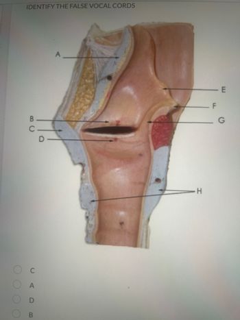 IDENTIFY THE FALSE VOCAL CORDS
В
С
С
A
о
В
D
A
Н
UL
G