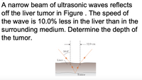 A narrow beam of ultrasonic waves reflects
off the liver tumor in Figure . The speed of
the wave is 10.0% less in the liver than in the
surrounding medium. Determine the depth of
the tumor.
12.0 cm
50.0°
Liver-
Tumor
