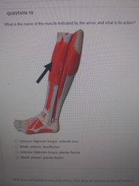 QUESTION 10
What is the name of the muscle indicated by the arrow, and what is its action?
extensor digitorum longus; extends toes
O tibialis anterior, dorsiflexion
O extensor digitorum longus; plantar flexion
O tibialis anterior, plantar flexion
Click Save and Submit to save and submit. Click Save All Answers to save all answers.
