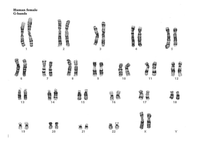 Answered: Human female G-bands | bartleby