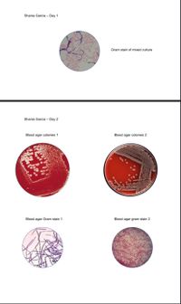 Shania Garcia - Day 1
Gram stain of mixed culture
Shania Garcia - Day 2
Blood agar colonies 1
Blood agar colonies 2
Blood agar Gram stain 1
Blood agar gram stain 2
