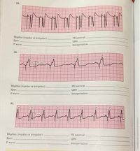 29.
Rhythm (regular or irregular):
PR interval:
Rate:
QRS:
P wave:
Interpretation:
30.
imV
Rhythm (regular or irregular):
PR interval
Rate:
QRS:
P wave:
Interpretation:
31.
Rhythm (regular or irregular):
PR interval:
Rate:
QRS:
P wave:
Interpretation:
a a
