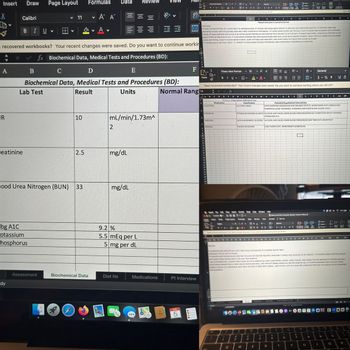 Insert Draw
Page Layout
Formulas
Data Review
Times New Roman
A A
aste
I UN
General
$ %"
Conditional Format
Cell
Styles
X
Calibri
11
く
Α Α
ab
Open recovered workbooks? Your recent changes were saved. Do you want to continue working where you left off?
B
C
D
G
H
I
Patient interview in narrative format:
Interview:
B
I
U v
V
A▾
Qil
B
O
Pe
Analyze
Data
Create PDF
and share link
Yes
L
M
N
recovered workbooks? Your recent changes were saved. Do you want to continue workin
Xfx Biochemical Data, Medical Tests and Procedures (BD):
PT WAS FOUND SITTING IN A CHAIR NEXT TO HEMODIALYZER. PT STATED HER USUAL BODY WEIGHT IS AROUND 140-142# AFTER DIALYSIS. PT APPEARS TIRED AND
REPORTED A FAIR APPETITE/EATING AROUND THREE-FOURTHS OF HER MEALS; PT LISTED SOME FOODS SHE TYPICALLY EATS AT HOME (HER HUSBAND HELPS PREPARES
THEM); PT WAS SURPISED SHE SHOULD BE EATING MORE PROTEIN AS HER DOCTOR TOLD HER NOT TO IN THE PAST. PT ASKED QUESTIONS: HOW MUCH PROTEIN TO EAT,
WHAT TYPES OF PROTEIN TO EAT, IF VEGETARIAN DINNERS ARE OKAY (BLACK BEANS AND RICE), HOW MUCH WATER TO DRINK, WHAT TYPES OF THINGS SHE CAN DRINK
(LIKES DIET PEPSI), HOW TO AVOID BEING THIRSTY, DAIRY OPTIONS AND AMOUNTS, AND WHAT KINDS OF FOODS THAT COUNT AS FLUIDS.
PT STATED SHE IS "GETTING TIRED"; PT AGREES TO DISCUSSING SODIUM, POTASSIUM, AND PHOSPHORUS TOMORROW (05/08/2020).
A
B
FR
C
D
E
Biochemical Data, Medical Tests and Procedures (BD):
Lab Test
Result
Units
10
mL/min/1.73m^
2
7
10
F
Times New Roman
10
Paste
BIU V
田、
♥ A A
A
悲
General
V $ % 9
✓
Open recovered workbooks? Your recent changes were saved. Do you want to continue working where you left off?
Normal Rangl
T9
xvfx
A
B
C
D
G
1
2
Medication
E F
H I JK L
FH-3.1.1 Prescription medication use:
Classification
N
P
Q
R S
T U
V
W
X Y
Z
AA
AB
Potential Drug Nutrient Interactions
GLUCOTROL
SULFONYLUREAS
SUPPLEMENTING MAGNESIUM MAY ENHANCE EFFECTS, WHEN TAKEN WITH GINKGO MAY
WORSEN GLUCOSE TOLERANCE, VITAMIN B2 MAY RAISE BLOOD SUGAR LEVELS
POTASSIUM SPARING DIURETIC ALCOHOL MAY CAUSE LOWER BLOOD PRESSURE/AVOID SALT SUBSITUTES WHICH INCREASE
POTASSIUM LVLS
DYRENIUM
CARDURA
RENAGEL
PHOSPHATE BINDER
ALPHA-ADRENERGIC BLOCKER ALCOHOL MAY CAUSE LOWER BLOOD PRESSURE/DO NOT TAKE WITH GRAPEFRUIT
LOW PHOSPH DIET, INTERFERENCE W/ANTACIDS
8
9
10
11
12
13
14
eatinine
2.5
mg/dL
15
16
17
18
19
20
21
22
23
24
25
ood Urea Nitrogen (BUN)
33
mg/dL
bg A1C
otassium
hosphorus
9.2 %
5.5 mEq per L
5 mg per dL
Assessment
Biochemical Data
Diet Hx
Medications
Pt Interview
dy
FEB
LO
5
Paste
Excel File Edit View Insert Format Tools Data Window Help
AutoSave O
Insert Draw Page Layout
100%
Formulas Data Review View
Renal and DM2 Complete Student Version FINAL(3)
Acrobat Tell me
Calibri
11
A
General
$1%9
898
Conditional Format Cell
Formatting as Table Styles
Sort & Find &
Format
Fiter Select
Open recovered workbooks? Your recent changes were saved. Do you want to continue working where you left off?
1x
ABCDEE
Diet Ho
G
HIJKL
M
N
° P
Q
R ST
U V W X Y Z
AA
AB
AC
AD
PT REPORTS FAIR APPETITE BUT GETS TIRED WHILE ON DIALYSIS; PT IS EATING 70% OF TRAY..
OBTAINED TYPICAL DIET AT HOME:
PT REPORTS NOT EATING MUCH PROTEIN "BECAUSE MY DOCTOR TOLD ME I SHOULDN'T A WHILE AGO, BECAUSE OF MY KIDNEYS", PT REPORTS LIKING PROTEIN SOURCES
BUT HASN'T BEEN EATING MUCH THE LAST FEW MONTHS:
EGG FOR BREAKFAST, AVOIDS FRIED FOODS AS HER HUSBAND HAS HIGH CHOLESTEROL, CHEESE, GREEK YOGURT, AND PEANUT BUTTER INSTEAD OF CHICKEN AND BEEF,
VEGETARIAN DINNER ONCE A WEEK (BLACK BEANS AND RICE), DIET PEPSI (PT DRANK GINGER ALE BEFORE DIABETES DX), PT STOPPED DRINKING FRUIT JUICE BUT NOW
DRINKS CYRSTAL LITE LEMONADE, MILK ONCE OR TWICE A WEEK WITH CEREAL, USED TO EAT A LOT OF SUGAR FREE CANDY BUT REDUCED TO A COUPLE AFTER CRAMPING
AND DIARRHEA.
esc
Bochemical Data
Diet Hr
Medications
To be completed by intern
Launchpad
"
80
"
888
FA
Made with Basecamp
atv
MacBook Air
200
44
Di
8
"
@
#
4
%
&
2
3
4
5
6
7
8
9
Q
W
E
R
T
Y
9
710
1
0
-
0
P