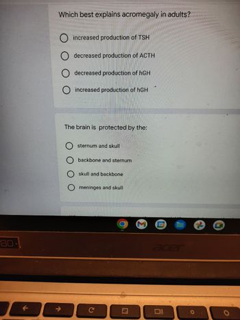 80-
Which best explains acromegaly in adults?
O increased production of TSH
decreased production of ACTH
decreased production of hGH
increased production of hGH
The brain is protected by the:
sternum and skull
backbone and sternum
skull and backbone
meninges and skull
O
31
acer
9
O