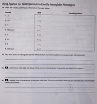 Using Agarose Gel Electrophoresis to Identify Hemoglobin Phenotypes
13. Draw the banding patterns you obtained on the space below.
Sample
Well
Banding pattern
1. A
1. 0
2. AS
2. O
3. S
3. O
4. Unknown
4. O
5. A
5. O
6. AS
6. O
7. S
7. 0
8. Unknown
8. O
14. Why does sickle cell hemoglobin behave differently from normal hemoglobin during agarose gel electrophoresis?
15.
+ A child is born with sickle cell disease. What can you conclude about the potential genotypes of the parents?
A mother finds out that her son is red-green color-blind. She is not color-blind. What can you conclude about her genotype?
Explain your answer.
16.
