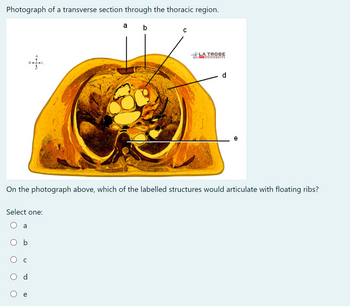 Photograph of a transverse section through the thoracic region.
Select one:
a
C
On the photograph above, which of the labelled structures would articulate with floating ribs?
d
a
e
b
C
LA TROBE
UNIVERSITY