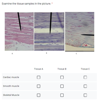 Examine the tissue samples in the picture. *
65
A
Tissue A
Tissue B
Tissue C
Cardiac muscle
Smooth muscle
Skeletal Muscle
