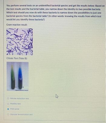 You perform several tests on an unidentified bacterial species and get the results below. Based on
the test results and the bacterial table, you narrow down the identity to two possible bacteria.
Which test should you now do with these bacteria to narrow down the possibilities to just one
bacterial species from the bacterial table? (In other words: knowing the results from which test
would let you identify these bacteria?)
Gram reaction result:
Citrate Test (Tube B):
O Nitrate reduction test
Motility test
MSA plate
O Glucose fermentation test
E