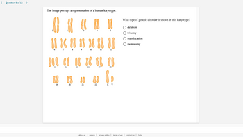 <
Question 6 of 12
The image portrays a representation of a human karyotype.
88 8 88 88 88 88
JOC (608
19
22
Y
What type of genetic disorder is shown in this karyotype?
deletion
O trisomy
translocation.
O monosomy
about us careers privacy policy terms of use contact us help