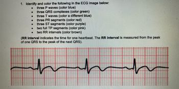 **ECG Analysis Instructions**

1. Identify and color the following in the ECG image below:
   - Three P waves (color blue)
   - Three QRS complexes (color green)
   - Three T waves (color a different blue)
   - Three PR segments (color red)
   - Three ST segments (color purple)
   - Two full TP segments (color pink)
   - Two RR intervals (color brown)

*(The RR interval indicates the time for one heartbeat. The RR interval is measured from the peak of one QRS to the peak of the next QRS).*

**Graph/Diagram Explanation**

The ECG image displays a standard electrocardiogram reading plotted on graph paper. Key components include:

- **P Wave**: The first small upward deflection, representing atrial depolarization.
- **QRS Complex**: The sharp, tall upward and downward deflections following the P wave, indicating ventricular depolarization.
- **T Wave**: The moderate upward deflection after the QRS complex, representing ventricular repolarization.
- **PR Segment**: The flat line between the end of the P wave and the start of the QRS complex.
- **ST Segment**: The flat line following the QRS complex and before the T wave.
- **TP Segment**: The flat line between the T wave and the next P wave.
- **RR Interval**: The time between consecutive QRS complexes, used to measure heart rate stability.