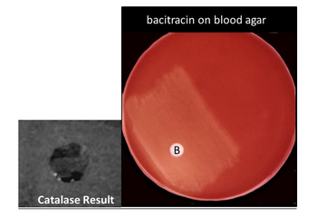 ### Image Transcription for Educational Website

The image displays two tests used for bacterial identification and antimicrobial susceptibility:

1. **Catalase Test Result:**
   - This section shows the result of a catalase test. A positive catalase result is indicated by the presence of bubbles, which signifies the release of oxygen gas. This test is used to identify organisms that produce the enzyme catalase, commonly used to differentiate between bacterial species, particularly Gram-positive cocci. 

2. **Bacitracin Test on Blood Agar:**
   - The second section shows a petri dish containing blood agar with a clear area labeled "B." This demonstrates a bacitracin susceptibility test. A zone of inhibition around the "B" indicates that the organism is susceptible to bacitracin. Blood agar is used as a nutrient-rich medium to grow a variety of bacteria and observe hemolytic activity. The presence of an inhibition zone is critical for identifying specific bacterial isolates, such as differentiating between Beta-hemolytic Streptococci. 

The tests depicted are fundamental in microbiology for differentiating and identifying bacteria based on their biochemical and susceptibility characteristics.