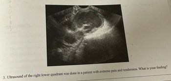 Answered: B 3. Ultrasound Of The Right Lower… | Bartleby