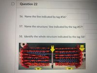 Question 22
56. Name the line indicated by tag #56?
57. Name the structure/ line indicated by the tag #57?
58. Identify the whole structure indicated by the tag 58?
56
57
58
58
