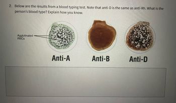 Understanding Blood Type Results