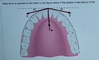 What force is exerted on the tooth in the figure below if the tension in the wire is 23 N?
01
F.
app
