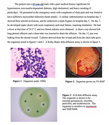 The patient was a 44 year-old male with a past medical history significant for
hypertension, non-insulin-dependent diabetes, high cholesterol, and heavy smoking (2
packs/day). He presented to the emergency room with complaints of chest pain and was found to
have suffered a myocardial infarction (heart attack). A cardiac catheterization on hospital day 3
showed three arterial occlusions, and he underwent a triple-bypass on hospital day 5. On day 7,
he developed septic shock with acute respiratory and renal failure, requiring intubation. He had
a fever at that time of 39.3° C and two blood cultures were obtained. A chest x-ray showed left
lung pleural effusion and a chest tube was inserted to drain the effusion. On day 11, pus was
leaking from the sternal wound. Cultures derived from the wound and from the chest tube grew
the organism noted in figures 1 and 2. A Kirby-Bauer disk diffusion assay is shown in figure 3.
Figure 1: Organism under 1000x
ANG 2
ALLEY CO
ALE S
Co
H
Feren bete
0.000
1984
Figure 2: Organism grown on 5% BAP
Figure 3: K-B disk diffusion assay.
The organism is shown to be
resistant gentamycin, oxacillin,
penicillin, and erythromycin. The
organism is sensitive to vacomycin
and TMP/SMX.
