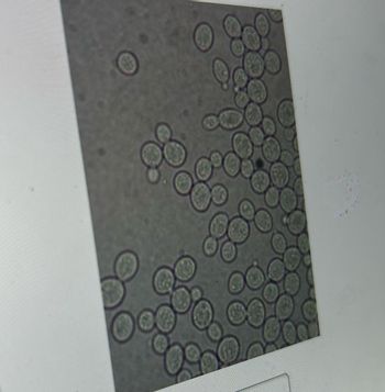 This image displays a microscopic view of yeast cells. Yeast are eukaryotic, single-celled microorganisms classified in the kingdom Fungi. The image shows numerous round to oval cells, each clearly outlined and densely packed within the field of view. 

**Key Features:**

- **Cell Structure**: Each cell appears round or slightly oval, typical of yeast morphology. The edges are well-defined, and the overall distribution offers insights into the colony density and growth pattern.
- **Magnification**: The high magnification allows for the observation of individual yeast cells, which can be useful for studying cell size and shape variations.
  
**Applications in Education:**

This image is a valuable resource for teaching about basic microbiology, cell biology, and the role of yeast in fermentation and baking. It can also be used to demonstrate laboratory techniques in microscopy and the study of microorganisms.