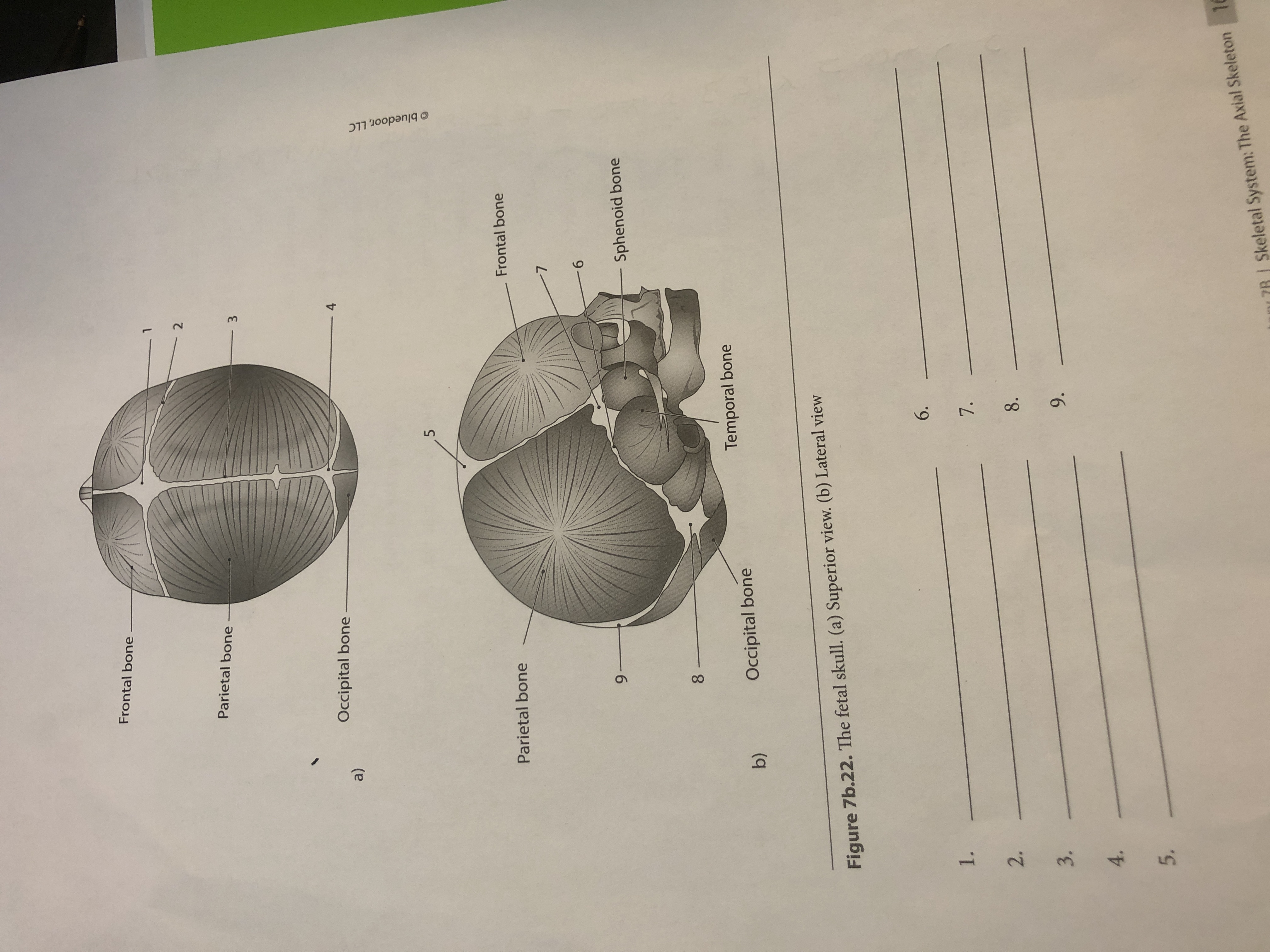 Frontal bone
Parietal bone
3
Occipital bone
4
a)
Parietal bone
Frontal bone
9.
9-
Sphenoid bone
8.
Temporal bone
b)
Occipital bone
Figure 7b.22. The fetal skull. (a) Superior view. (b) Lateral view
6.
1.
7. -
2.
8.
3.
9.
4.
7R | Skeletal System: The Axial Skeleton 16
5.
O bluedoor, LLC

