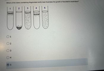 Which of the tubes (containing thigylcolate broth) best illustrates the growth of facultative anaerobes?
1
2
3
88888
01
2
3
4
5
5
....