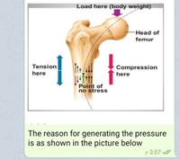 Load here (body weight)
Head of
femur
Tension
Compression
here
here
Point of
no stress
The reason for generating the pressure
is as shown in the picture below
P 3:07 /
