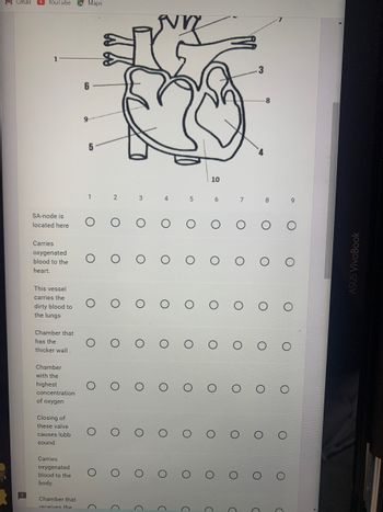 M Gmail YouTube Maps
6
SA-node is
located here
Carries
oxygenated
blood to the
heart.
This vessel
carries the
dirty blood to
the lungs
Chamber that
has the
thicker wall.
Chamber
with the
highest
concentration
of oxygen
Closing of
these valve
causes lubb
sound.
Carries
oxygenated
blood to the
body.
Chamber that
receives the
9
5
1
O
O
O
O
O
O
C
3
C
O
O
O
O
O
O
4
O
O
O
O
O
O
O
D
5
10
6
O
O
O
7
O
O
O
O
3
O
O
8
O
O
9
O
O
ASUS VivoBook