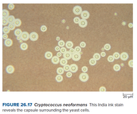 Image: India Ink Stain (Cryptococcus neoformans) - Merck Manuals  Professional Edition