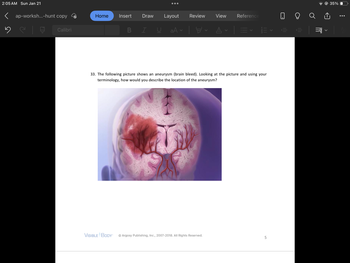 2:05 AM Sun Jan 21
5
ap-worksh...-hunt copy
Calibri
Home Insert
B
Draw Layout Review View Reference
I
aA✓ ✓ ✓ ||
33. The following picture shows an aneurysm (brain bleed). Looking at the picture and using your
terminology, how would you describe the location of the aneurysm?
VISIBLE BODY Ⓒ Argosy Publishing, Inc., 2007-2018. All Rights Reserved.
5
0 9
ili
=¶ \
35%