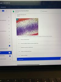 **Unit 5 Review: Check Your Recall**

Homework

**Identify the tissue in E below.**

[Image of tissue with a purple and pink-stained appearance, showing layers of cells with distinct nuclei.]

**Select an answer and submit. For keyboard navigation, use the up/down arrow keys to select an answer.**

a. Osseous (bone) tissue

b. Pseudostratified ciliated columnar epithelium

c. Stratified squamous epithelium

d. Simple cuboidal epithelium

e. Hyaline cartilage

**Unanswered**

---

The image shows a stained tissue section, highlighting a distinct pattern that may help in identifying the type of tissue. Each option represents a different tissue type with unique cellular structures. To determine the correct type, consider the layering, shape, and arrangement of the cells, as well as the presence of any specific features like cilia or cartilage.