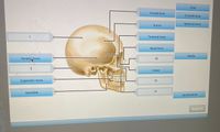 Orbit
Frontal bone
Occipital bone
Sphenoid bone
Suture
Temporal bone
Nasal bone
Maxilla
Parieta bone
10
3.
Vomer
Zygomatic bone
12
Mandible
Lacrimal bone
Submit
13
