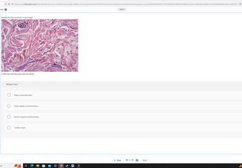 suesi
8 https://ezto.mheducation.com/ext/map/index.html?_con=con&external_browser=0&launch Url=https%253A%252F%252Fnewconnect.mheducation.com%252F#/activity/question-group/kEZASsBkEPtKtPCm7MmbWfnfHdUVRt6FoM786bP2newkeln 1eMqsVetrOupKMrHTk0kAlMa9i9XGBsihABgCnuRijOJOQKE Ⓒ
Identify the tissue shown in the image.
ⒸMcGraw-Hill Education/Dennis Strete
ch
Multiple Choice
Elastic connective tissue
Dense regular connective tissue
Dense irregular connective tissue
Cardiac muscle
91
Saved
< Prev
35 of 35
#
Next >