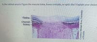 Is the retinal area in Figure the macula lutea, fovea centralis, or optic disc? Explain your choice.
Retina
Choroid
Sclera
Courtesy Michael Ross, University
of Florida
