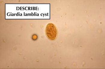 DESCRIBE:
Giardia lamblia cyst