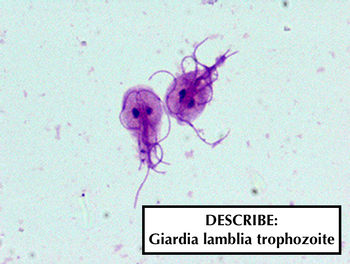 DESCRIBE:
Giardia lamblia trophozoite